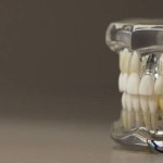 Implanty stomatologiczne - co powinno się o nich wiedzieć?